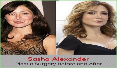 Sasha Alexander Plastic Surgery Before and After