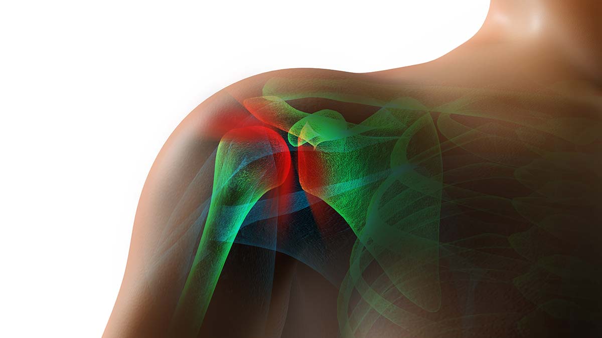 Physiotherapy Exercises for Shoulder Pain